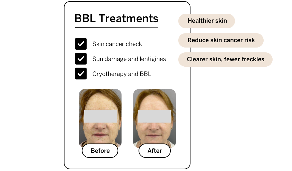 Before and after BL treatment call to action