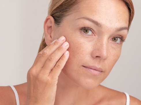 Woman with sun spots on her face