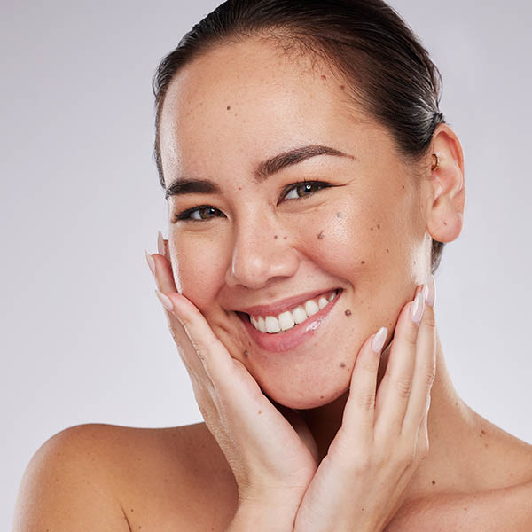 Young woman, smiling, facial moles