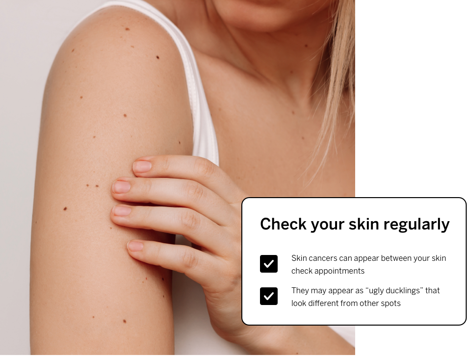 Skin self check regularly