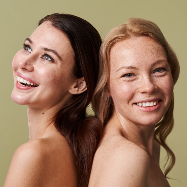 Two young women, one with acne scarring, another with fair skin and freckles