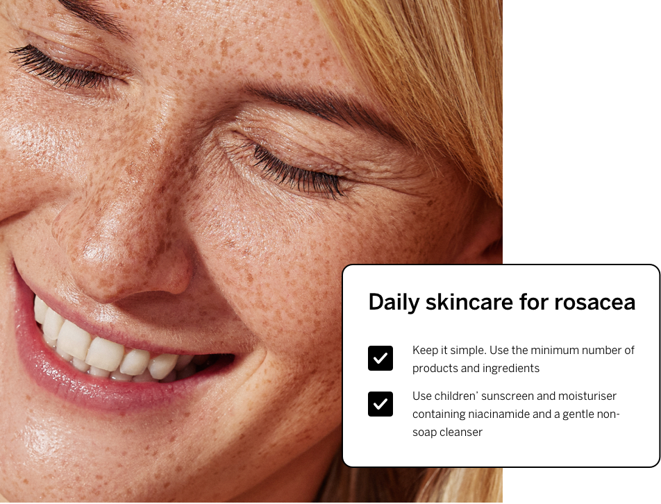 Daily skin care for rosacea - dot points