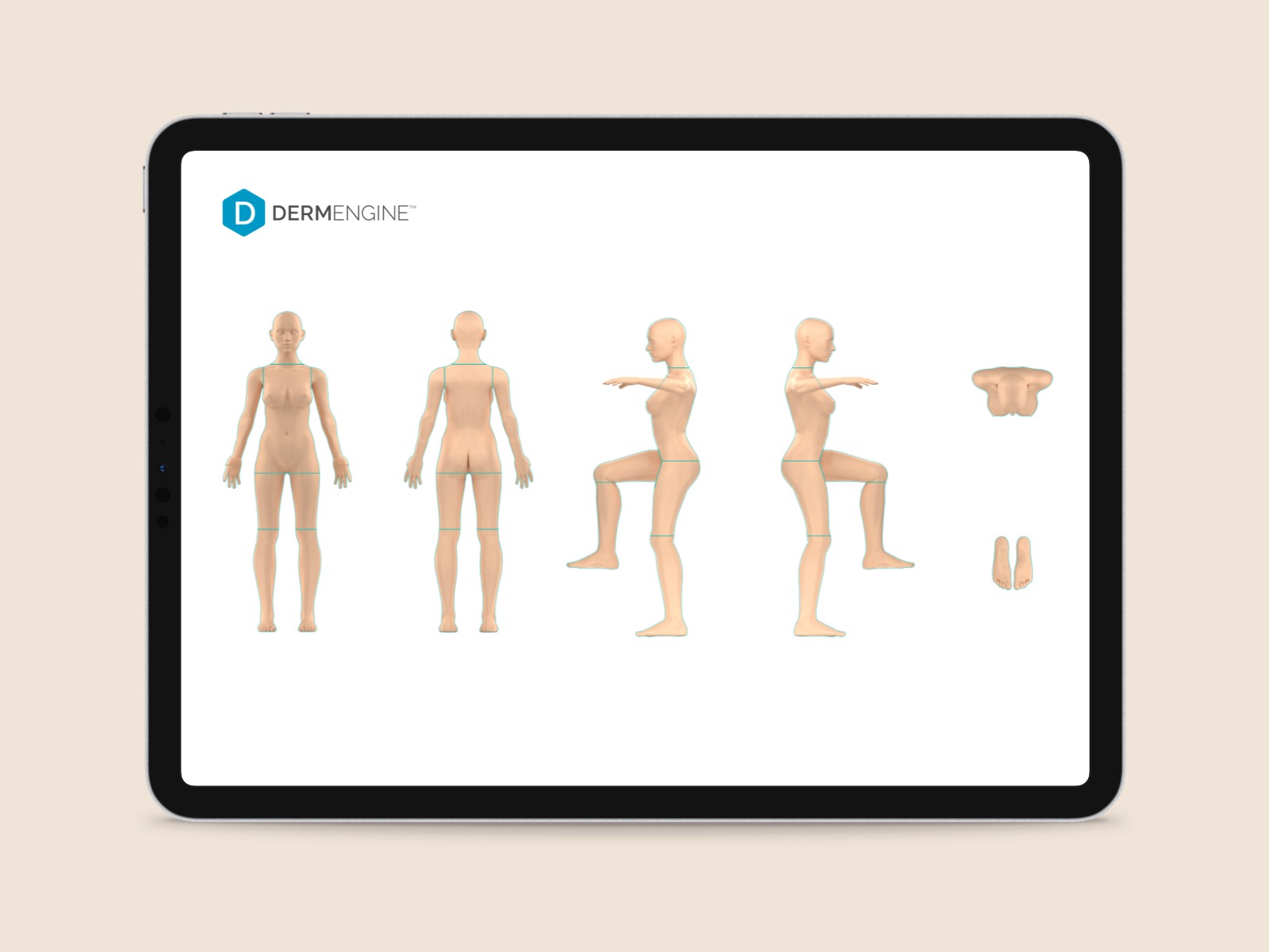 Diagram showing body regions and poses for mole mapping photography