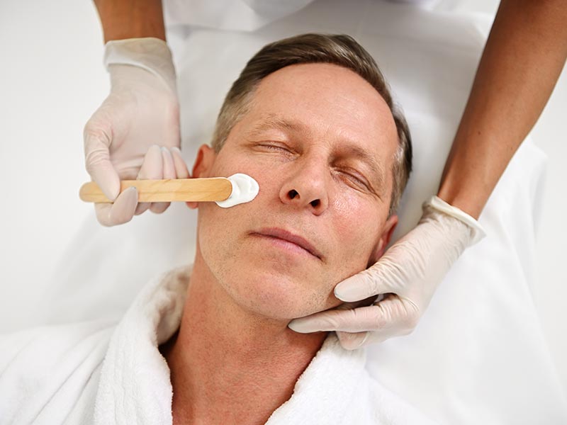 PDT: a clinician applies topical cream to a man's face using a spatula