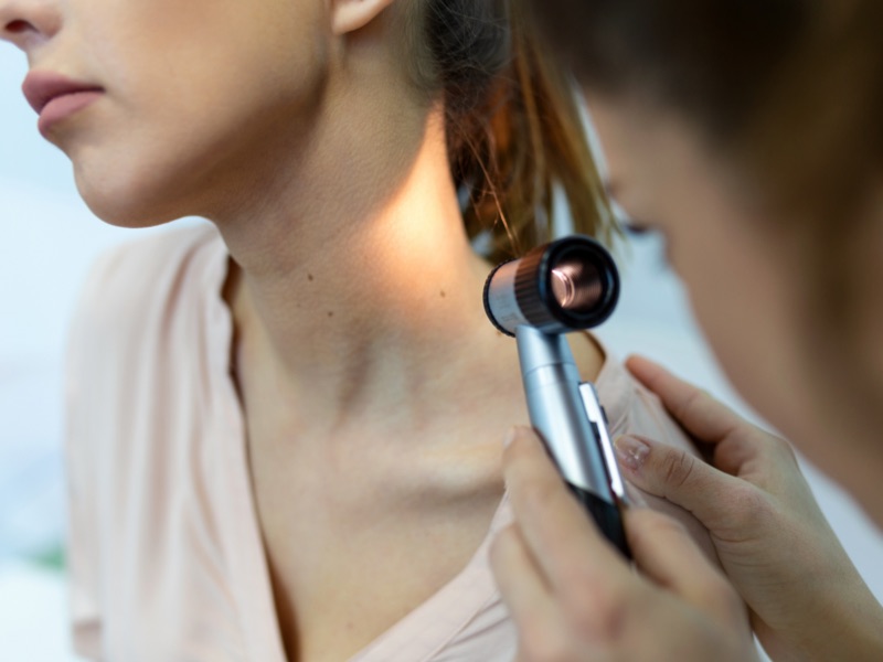 When to get a mole checked: Signs it’s time to schedule a check-up for your moles