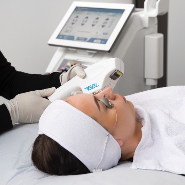 http://Energy-based%20treatments-%20Laser%20and%20BBL%20intense%20pulsed%20light