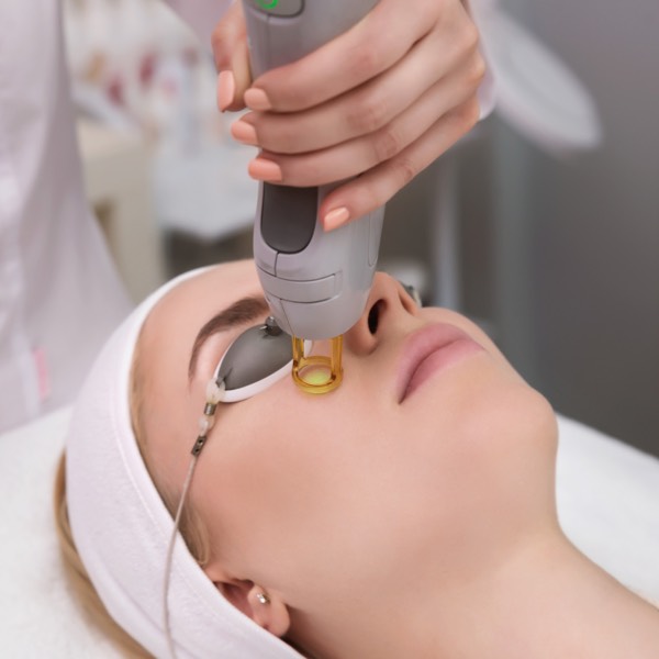 Laser treatment to young woman's face